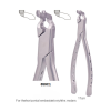 Adult - Root and fragments of horizontal impacted wisdom